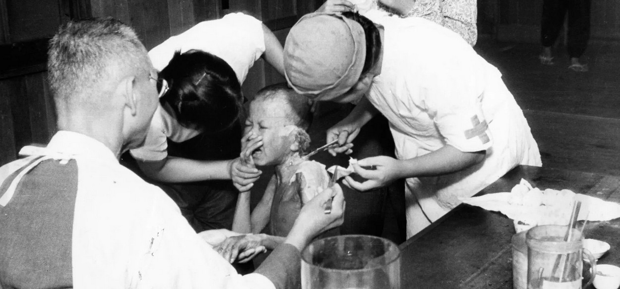Dampak radiasi nuklir pada perang dunia kedua Dampak radiasi nuklir