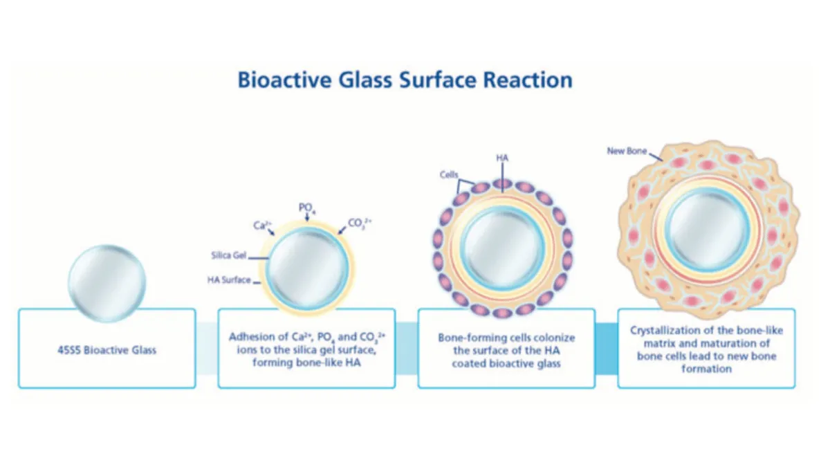 bioactive glass bioactive glass