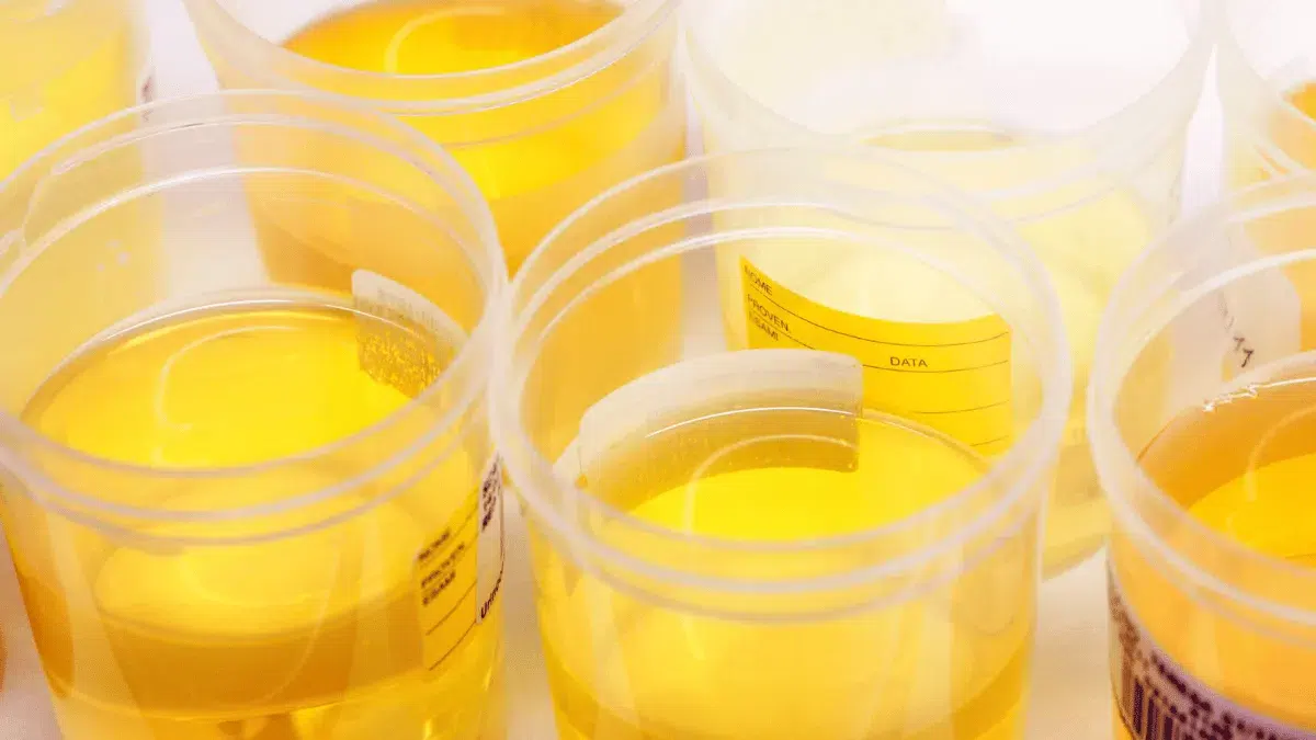 cara kerja pemanfaatan urine