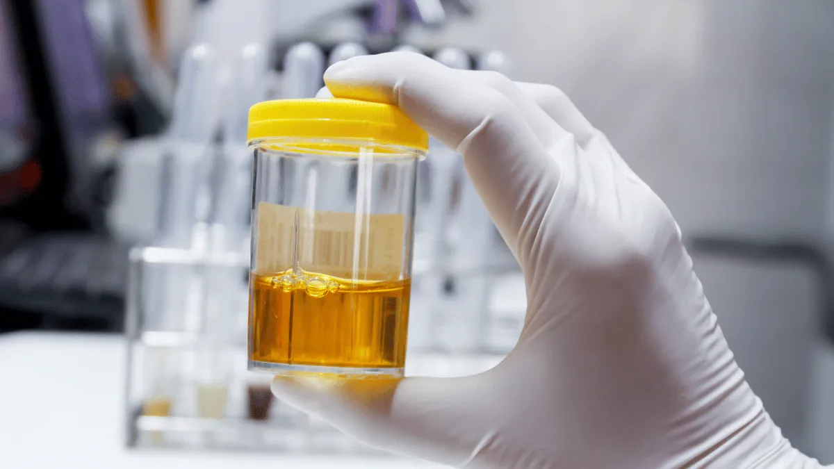 keuntungan urine manusia